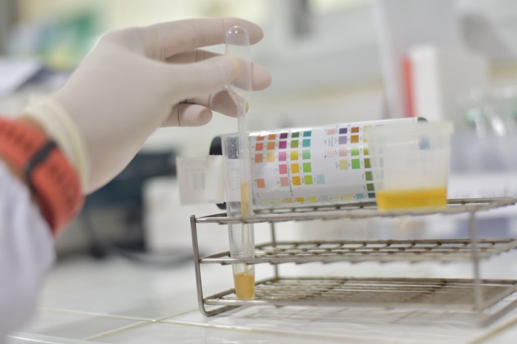 Every Detail You Should Know About Urine Drug Test Cups